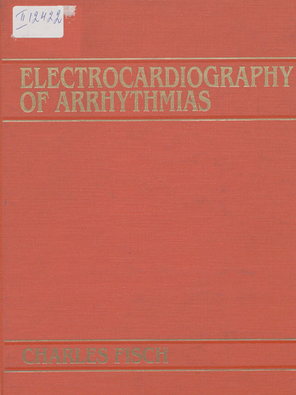 Electrocardiography of arrhythmias
