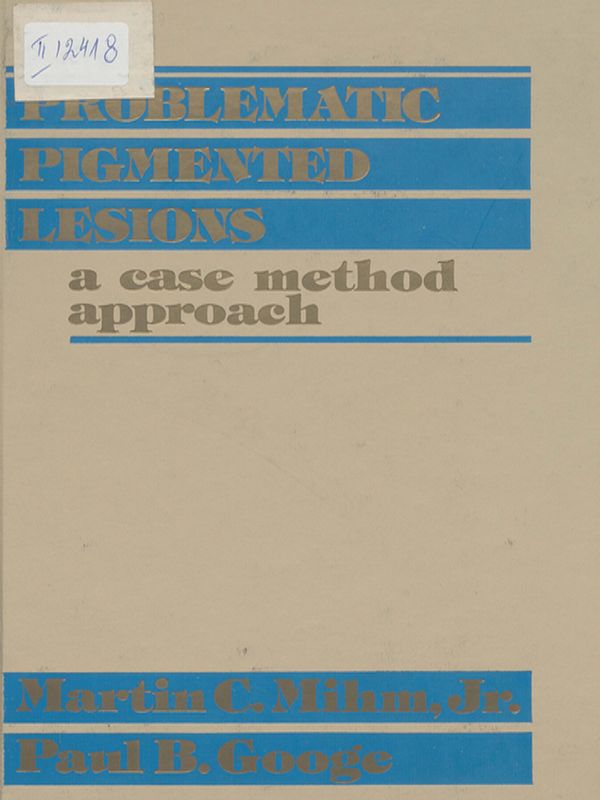 Problematic pigmented lesions