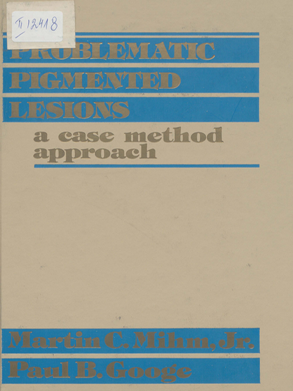 Problematic pigmented lesions