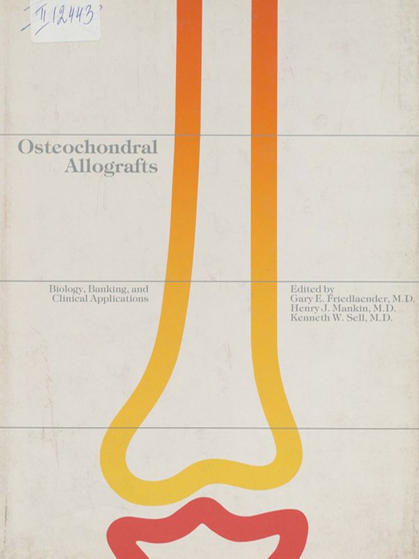 Osteochondral allografts