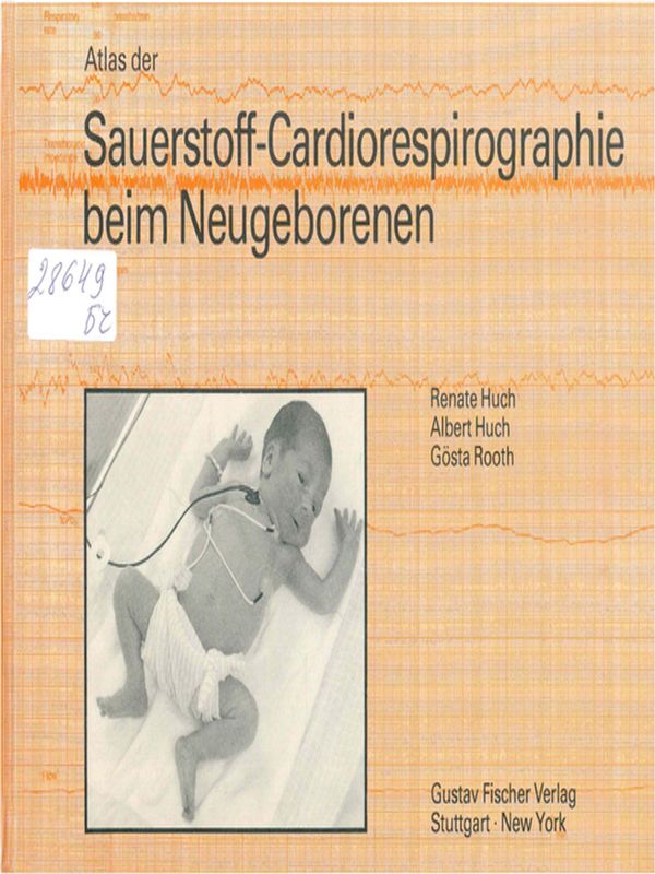 Atlas der Sauerstoff-Cardiorespirographie beim Neugeborenen