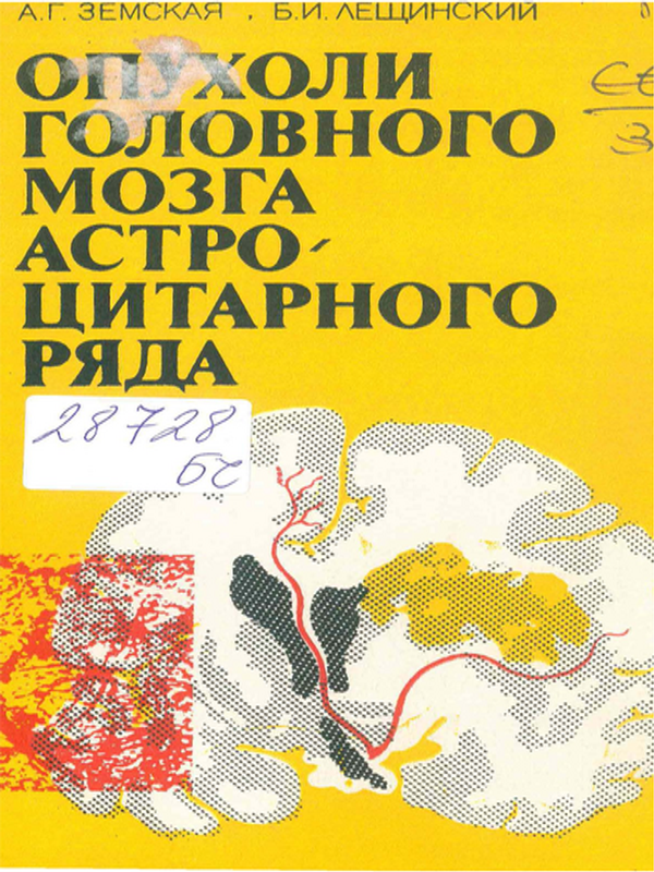 Опухоли головного мозга астроцитарного ряда