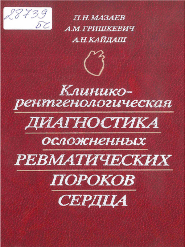 Клинико-рентгенологическая диагностика осложненных ревматических пороков сердца
