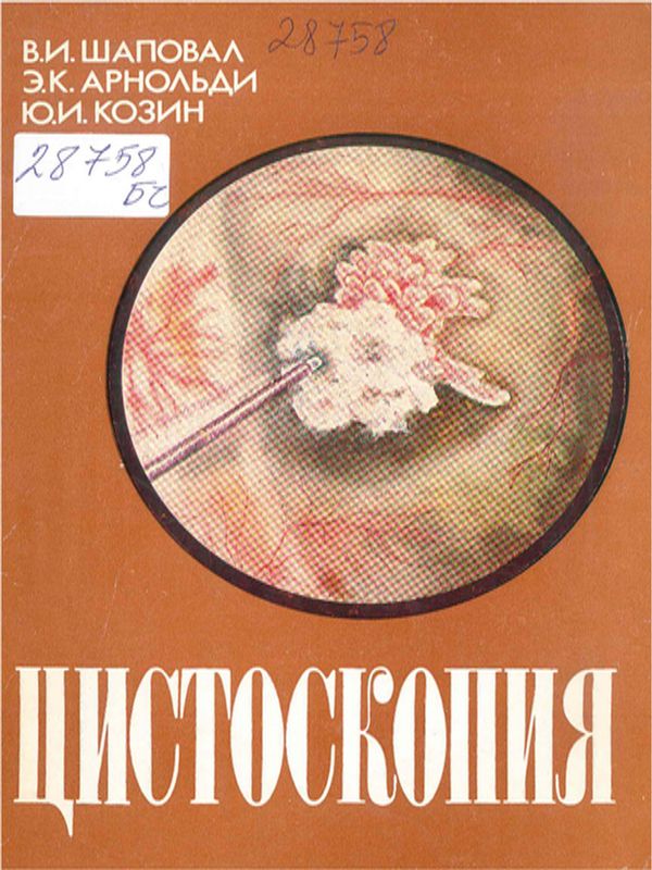 Цистоскопия