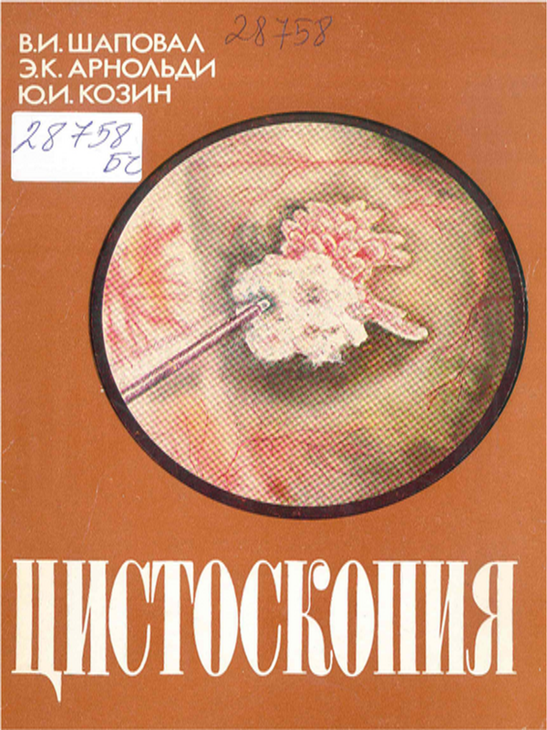 Цистоскопия