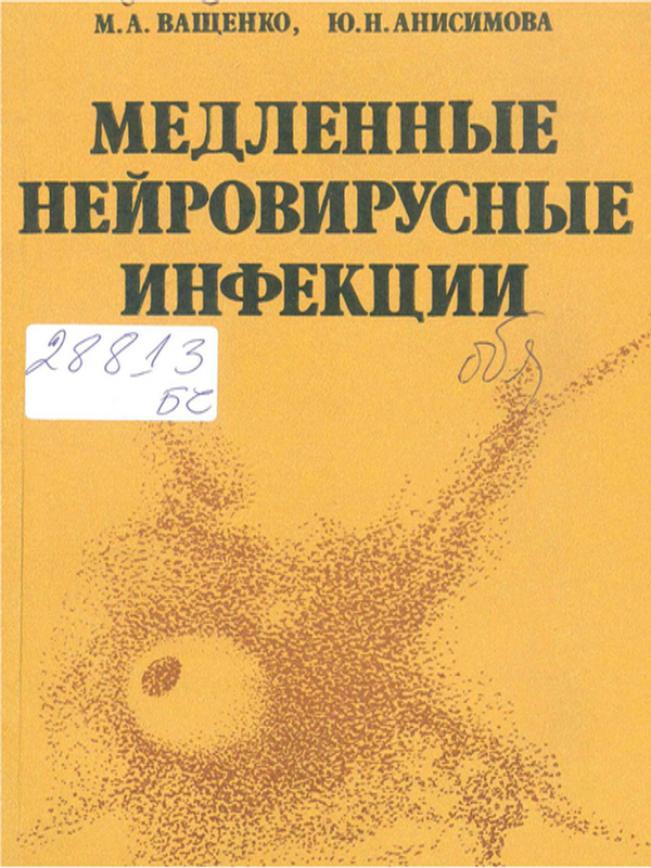 Медленные нейровирусные инфекции