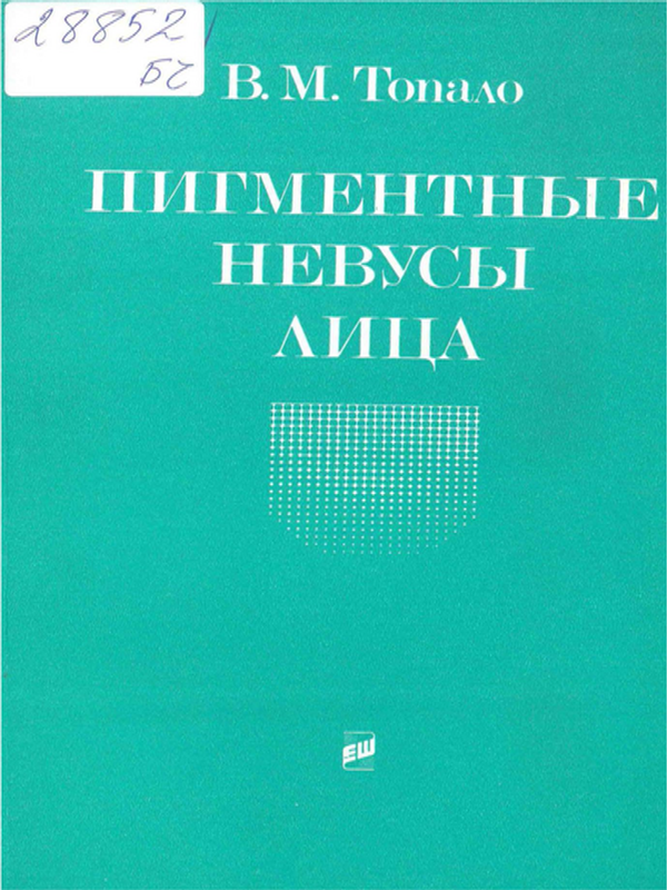 Пигментные невусы лица