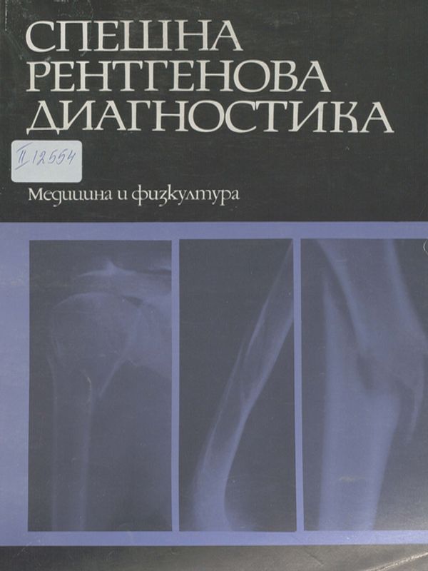 Спешна рентгенова диагностика