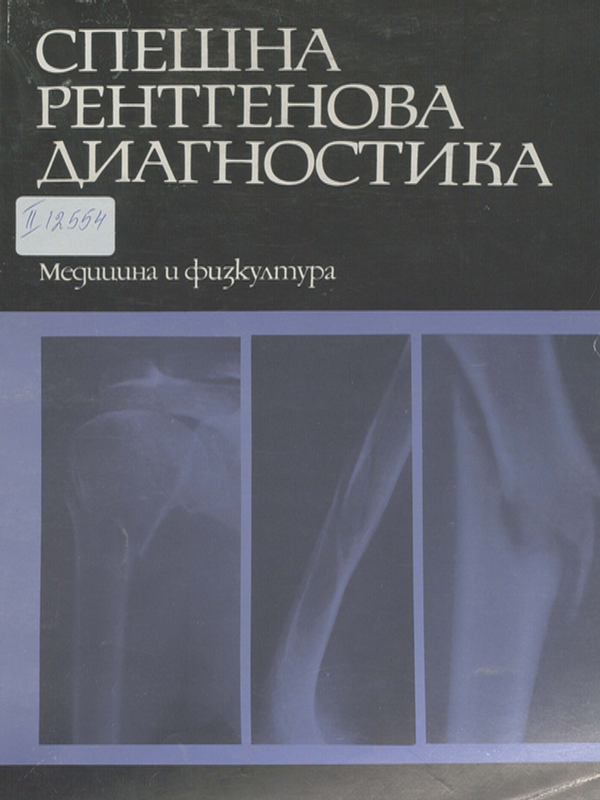 Спешна рентгенова диагностика