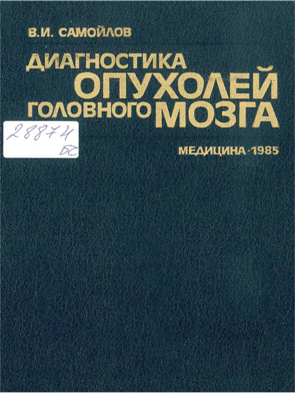 Диагностика опухолей головного мозга