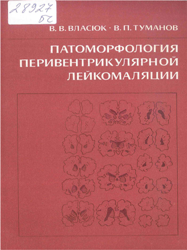 Патоморфология перивентрикулярной лейкомаляции