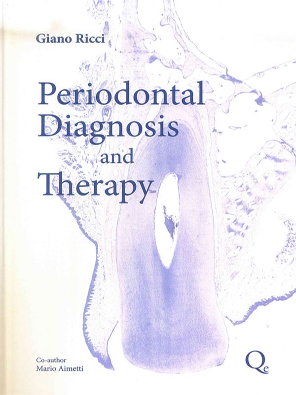 Periodontal Diagnosis and Therapy