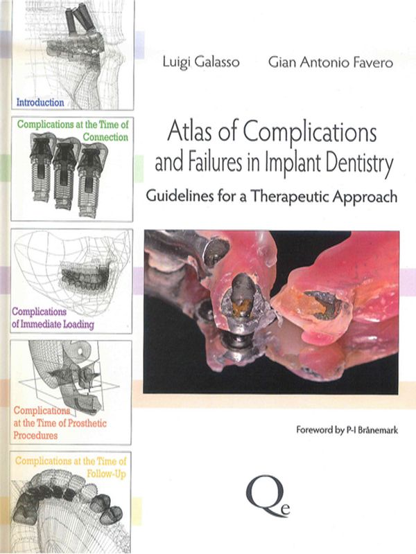 Atlas of Complications and Failures in Implant Dentistry