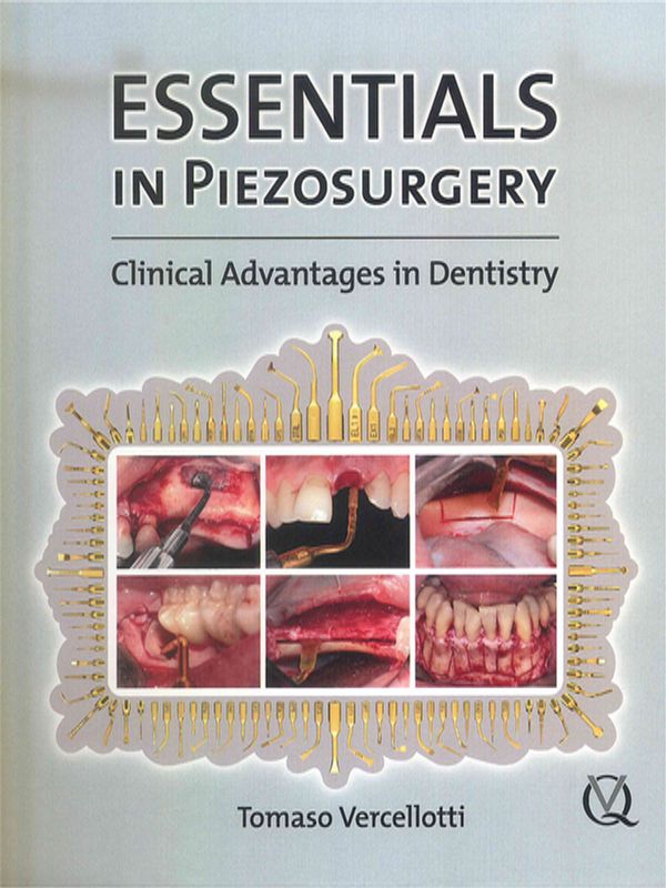 Essentials in Piezosurgery