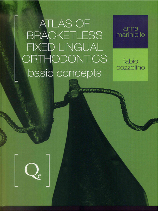 Atlas of Bracketless Fixed Lingual Orthodontics