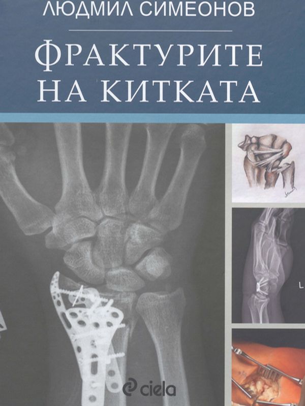 Фрактурите на китката