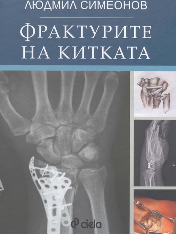 Фрактурите на китката