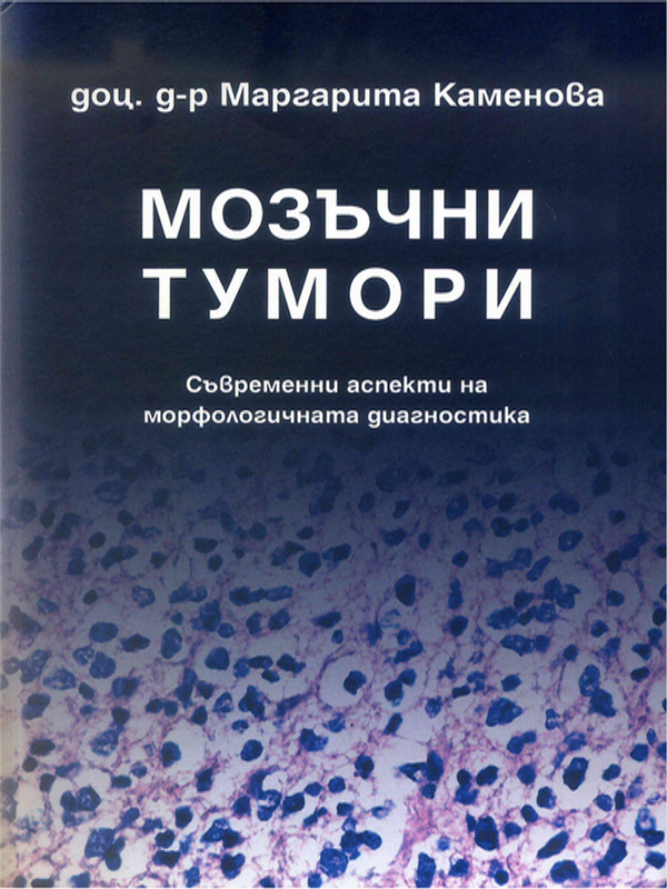 Мозъчни тумори