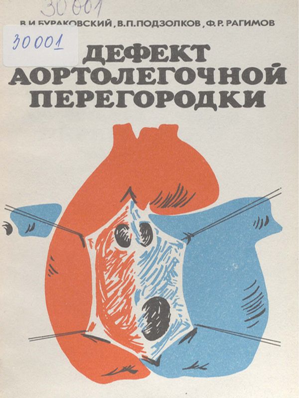 Дефект аортолегочной перегородки