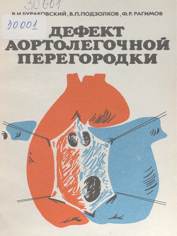 Дефект аортолегочной перегородки