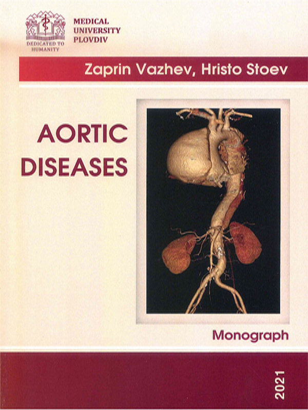 Aortic diseases