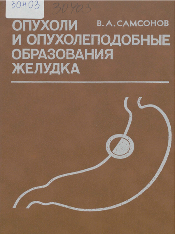 Опухоли и опухолеподобные образования желудка