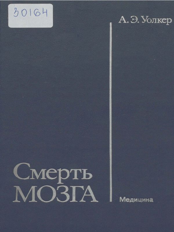 Смерть мозга