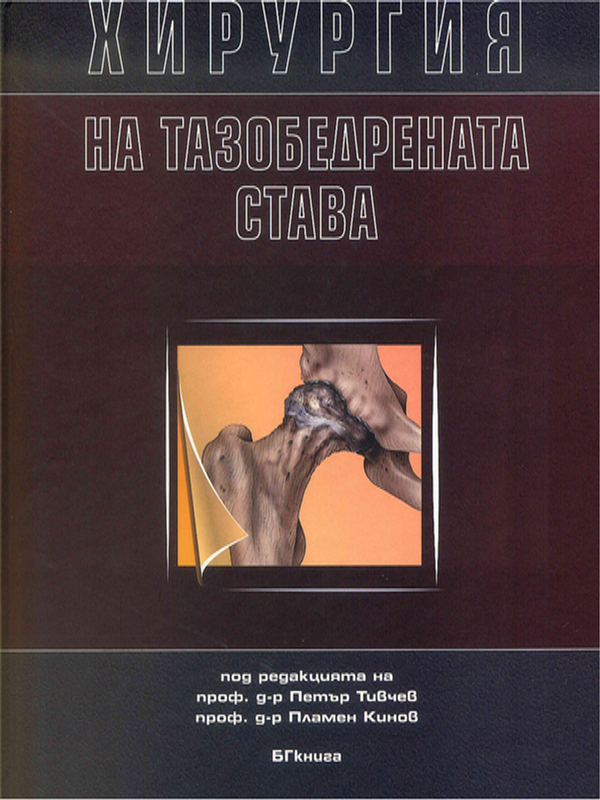 Хирургия на тазобедрената става