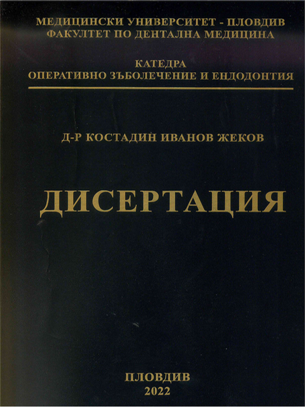 Обтуриране на корено-каналната система чрез хидравлична кондензация и биокерамичен сийлър