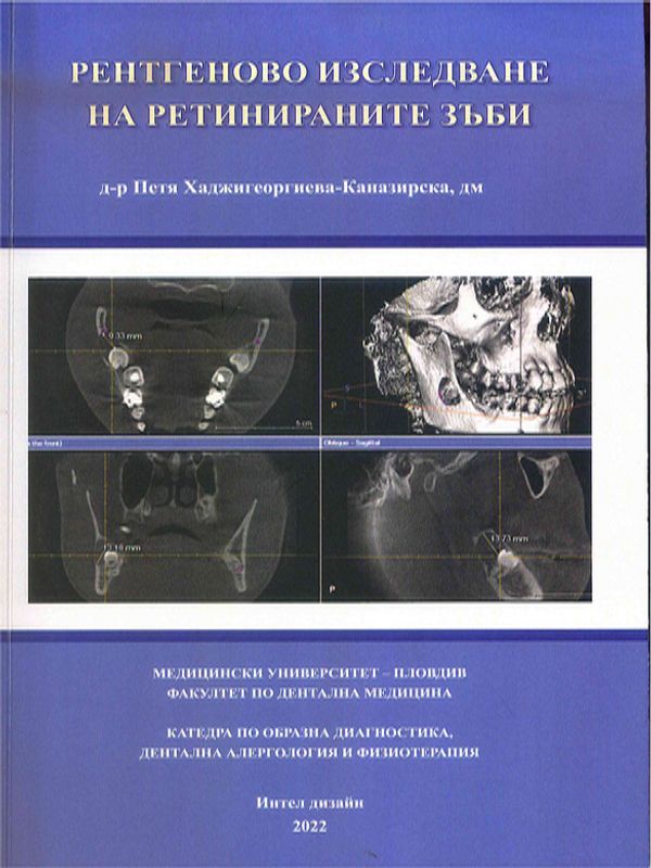 Рентгеново изследване на ретинираните зъби