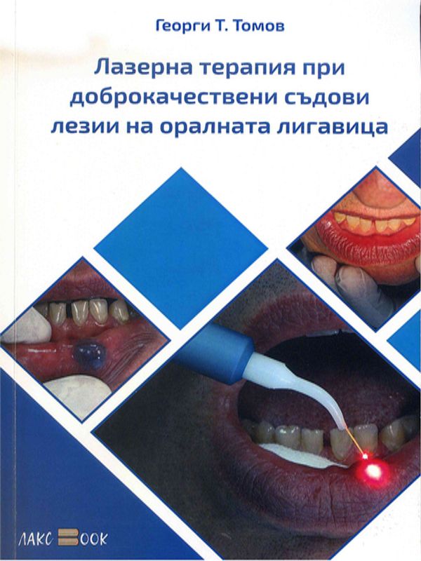 Лазерна терапия при доброкачествени съдови лезии на оралната лигавица