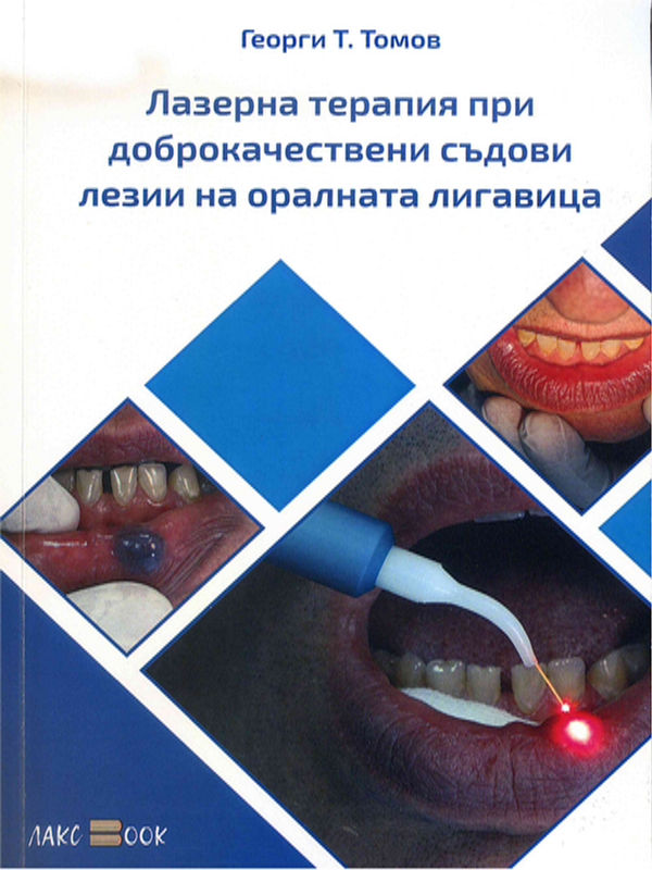 Лазерна терапия при доброкачествени съдови лезии на оралната лигавица