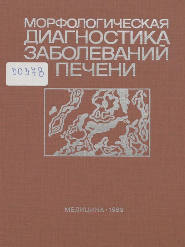 Морфологическая диагностика заболеваний печени