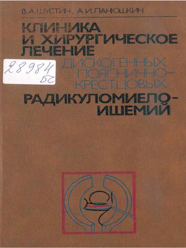 Клиника и хирургическое лечение дискогенных пояснично-крестцовых радикуломиелоишемий