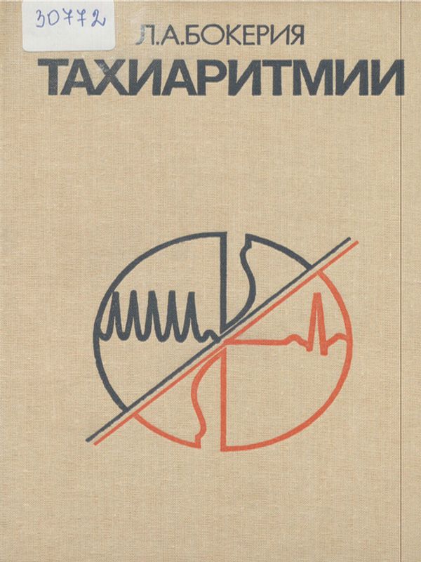 Тахиаритмии