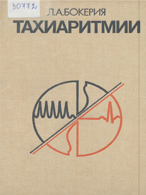 Тахиаритмии