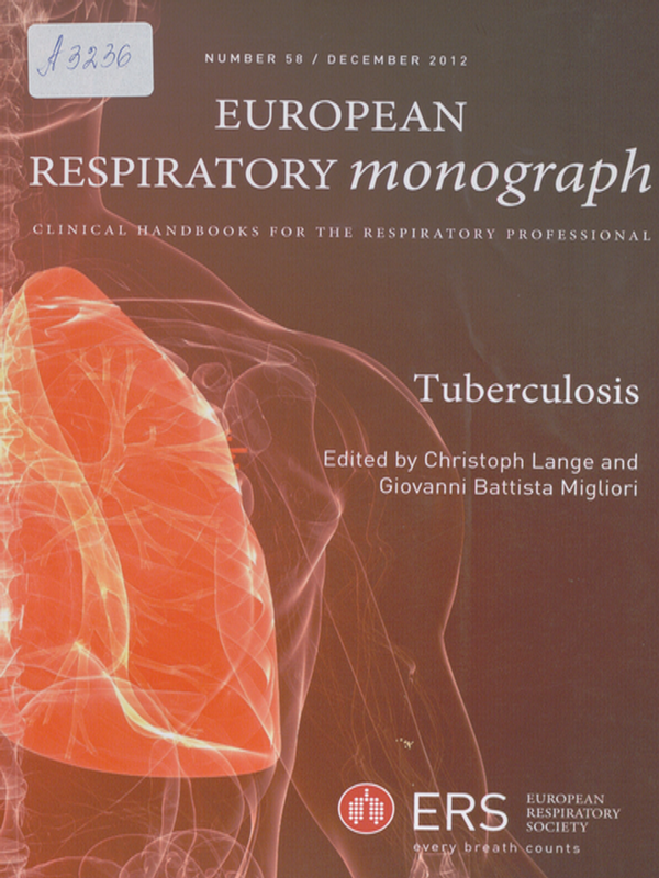 Tuberculosis