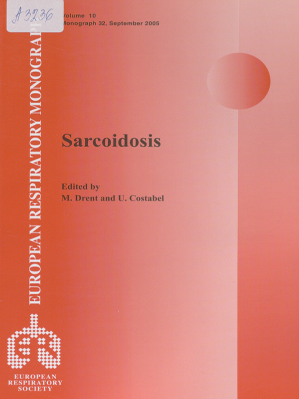 Sarcoidosis