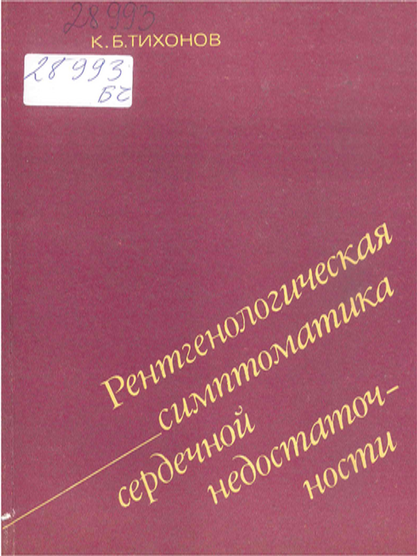 Рентгенологическая симптоматика сердечной недостаточности
