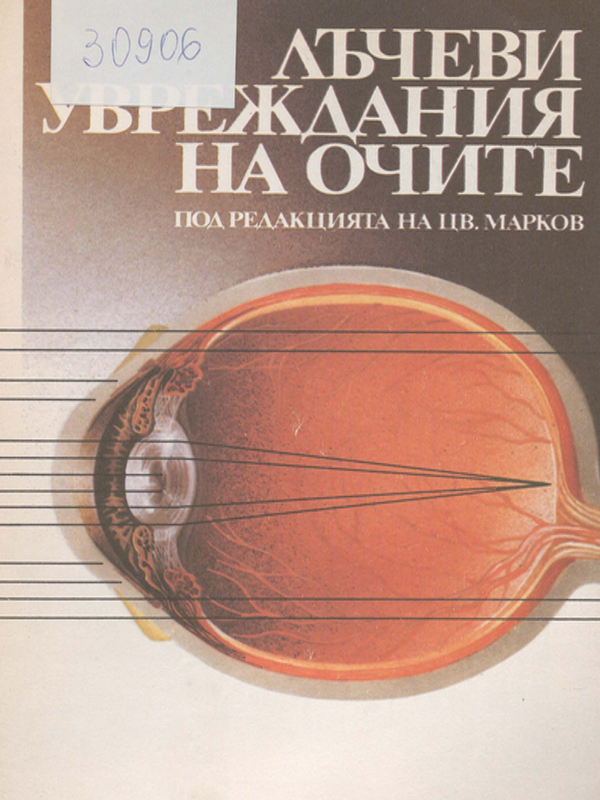 Лъчеви увреждания на очите