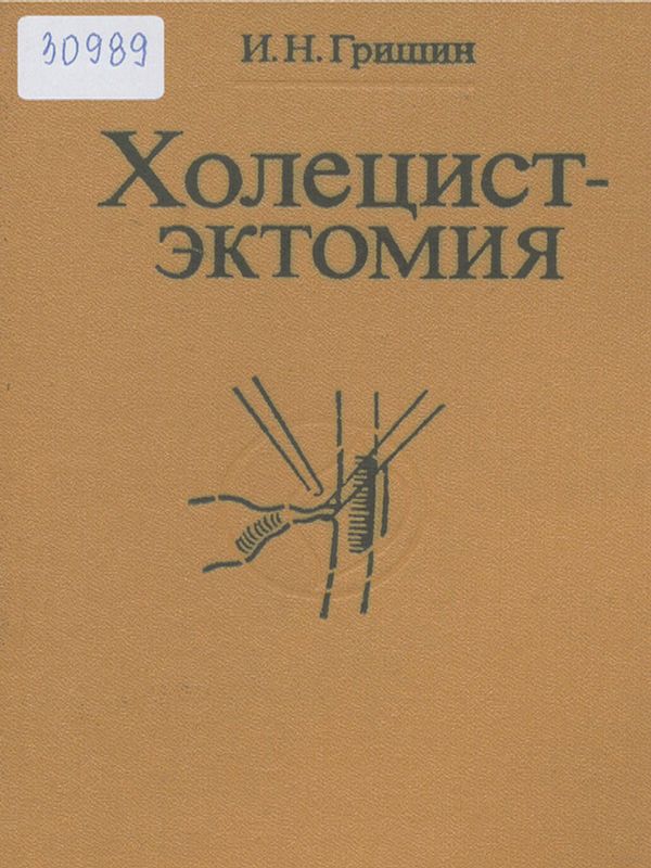 Холецистэктомия