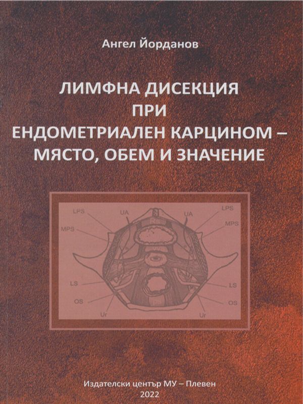 Лимфна дисекция при ендометриален карцином - място, обем и значение