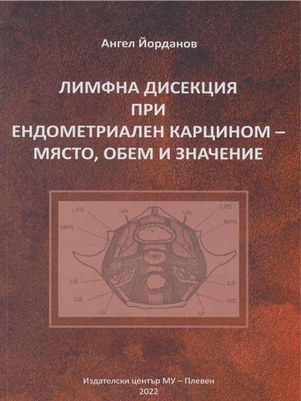 Лимфна дисекция при ендометриален карцином - място, обем и значение