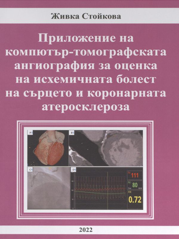 Приложение на компютър-томографската ангиография за оценка на исхемичната болест на сърцето и коронарната атеросклероза