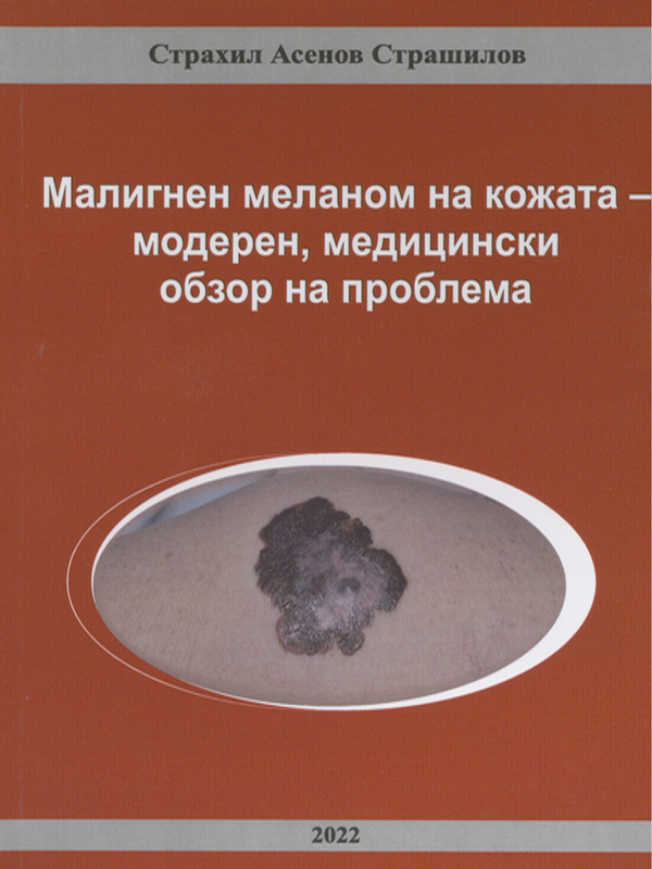 Малигнен меланом на кожата - модерен, медицински обзор на проблема