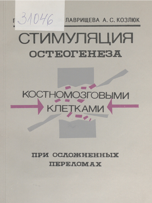 Стимуляция остеогенеза костномозговыми клетками при осложненных переломах
