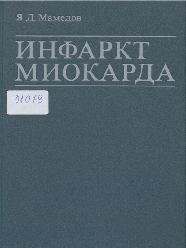 Инфаркт миокарда