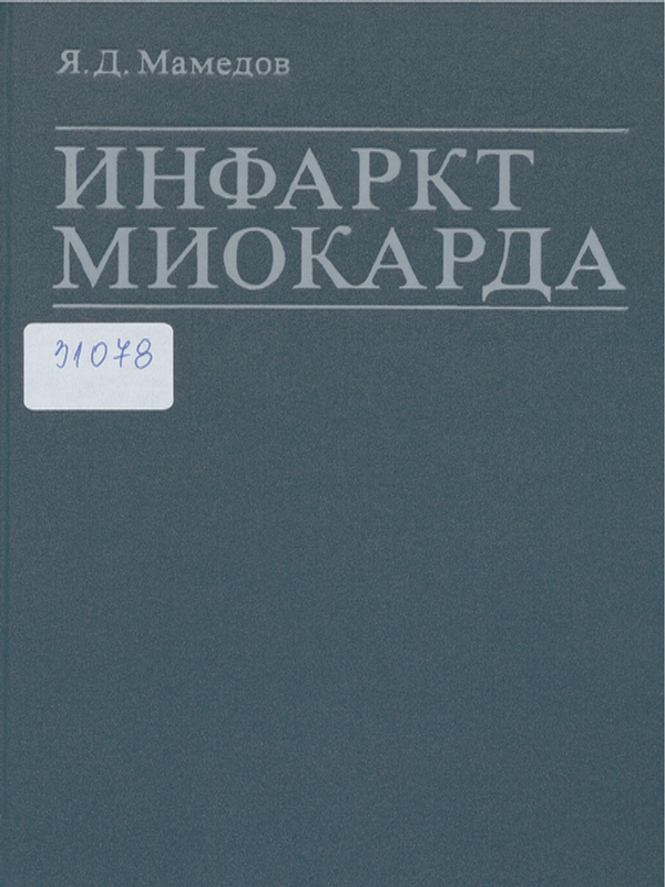 Инфаркт миокарда