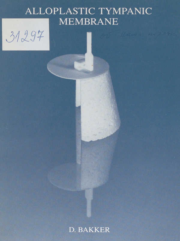 Alloplastic tympanic membrane