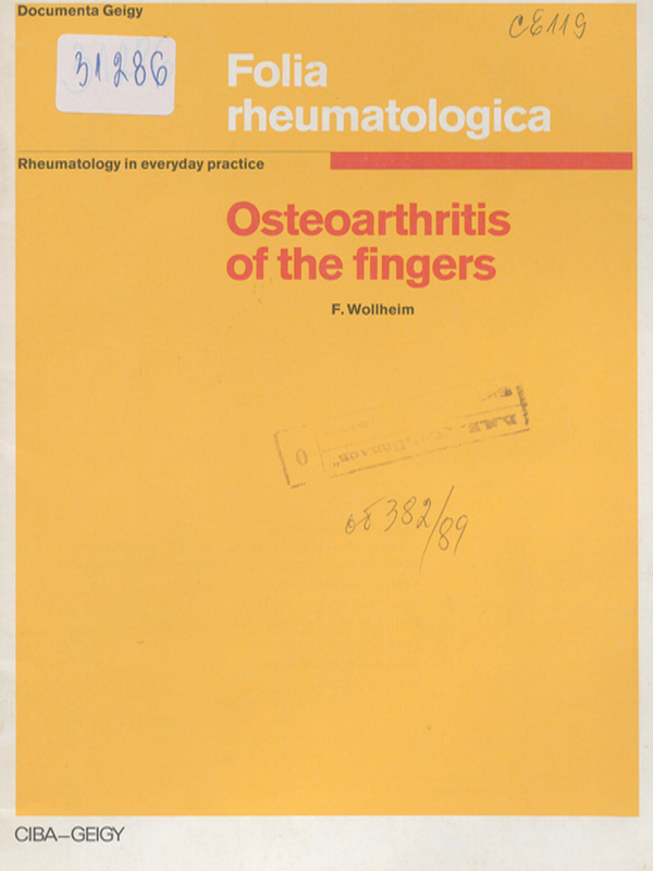 Osteoarthritis of the fingers